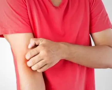 Eczema scratching