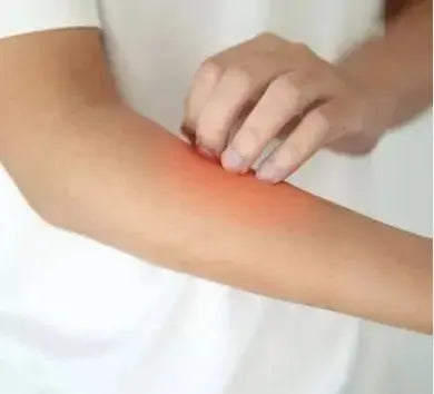 Eczema on a child's arm