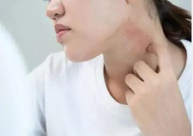 Sensitive Skin